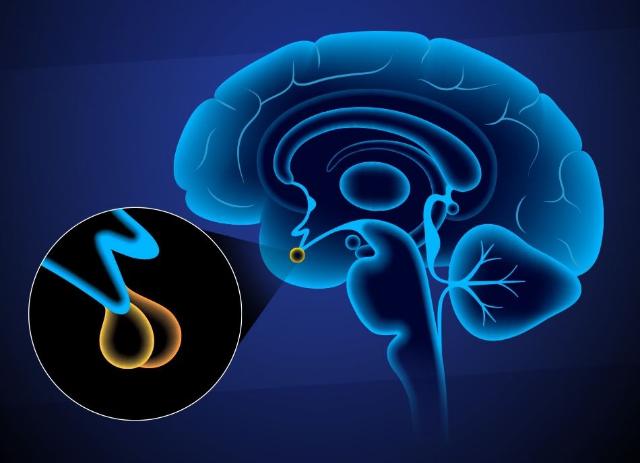 뇌 속 호르몬 관제탑 ‘뇌하수체’ 백과사전  2. 뇌하수체의 영상 검사 진단 관련사진