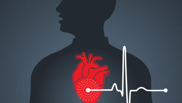 관상동맥 막혀 죽어가는 심장 새 혈관길 만드는 ‘관상동맥우회술’로 살려 관련사진